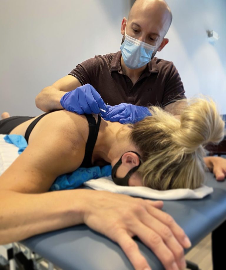 mjpt dry needling therapy